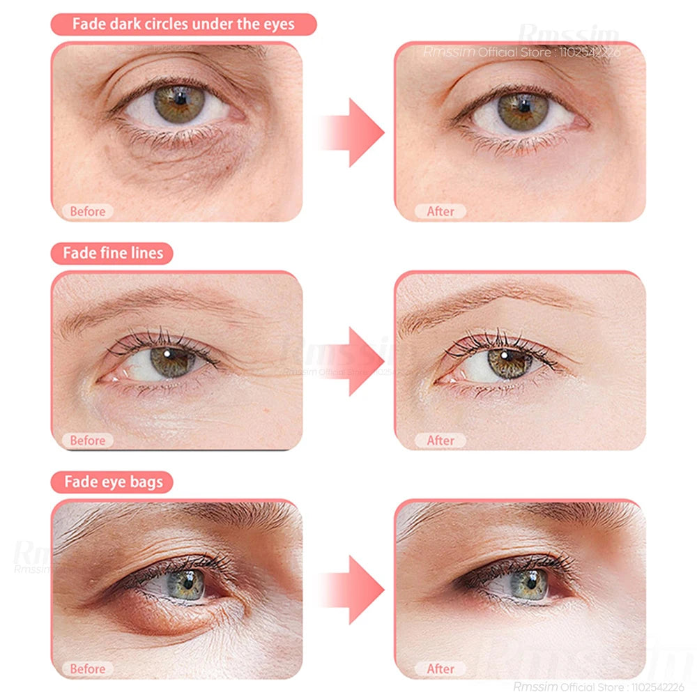 QUITA OJERAS 